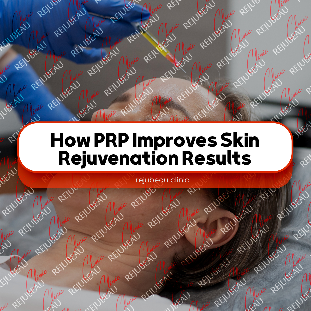 How-PRP-Improves-Skin-Rejuvenation-Results